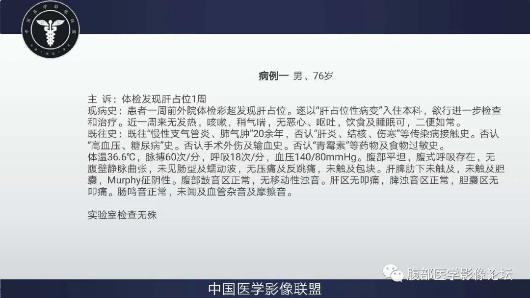 【病例】肝脏神经内分泌癌1例CT影像