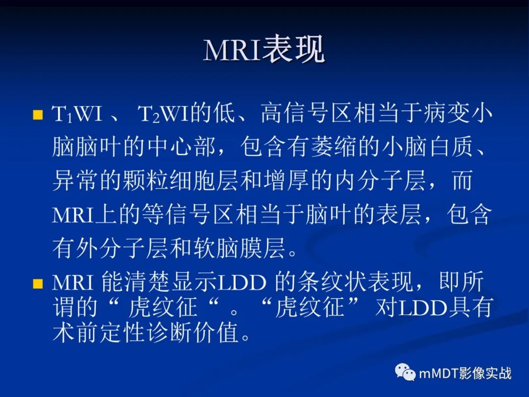 【PPT】小脑发育不良性神经节细胞瘤的MR诊断