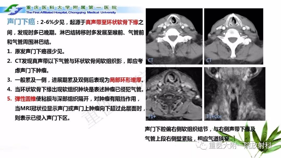 【PPT】咽部解剖及T分期影像诊断