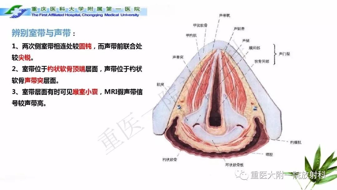 【PPT】咽部解剖及T分期影像诊断