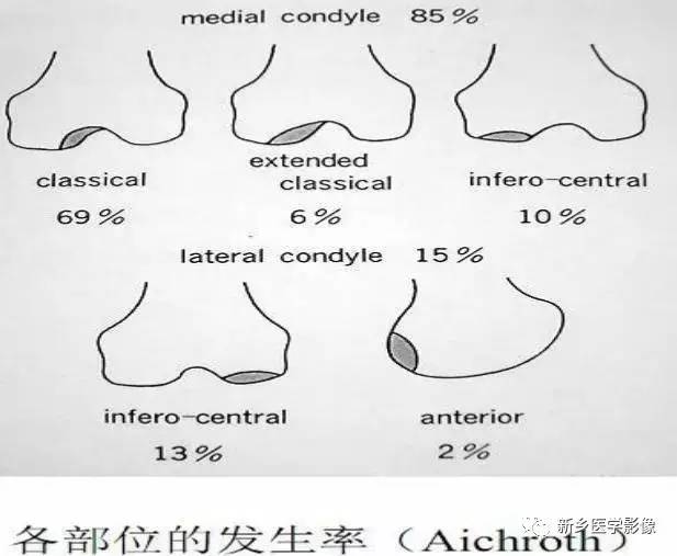 膝关节疼痛，应想到的22种疾病