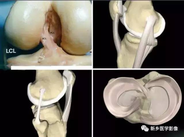 膝关节疼痛，应想到的22种疾病