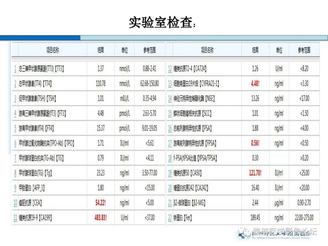 【病例】胰腺神经内分泌癌1例CT影像