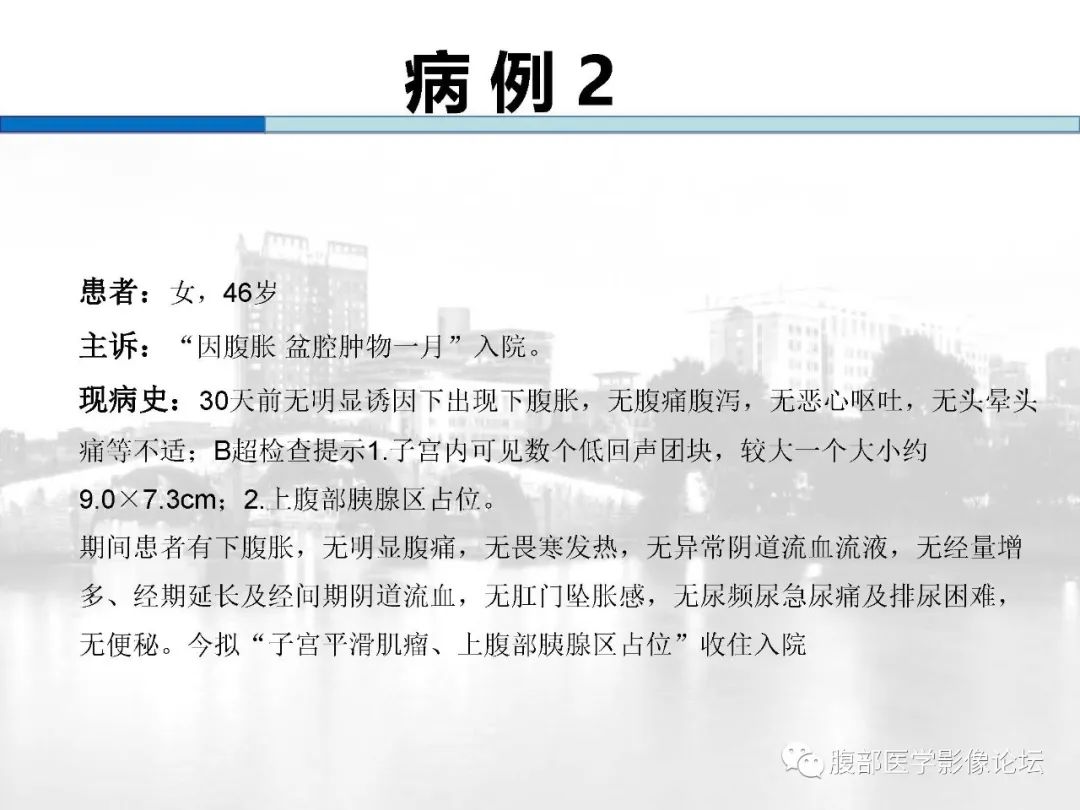 【病例】胰腺实性假乳头状肿瘤1例CT及MR