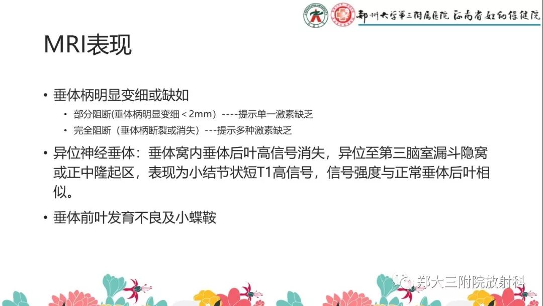 【PPT】先天性垂体发育不良