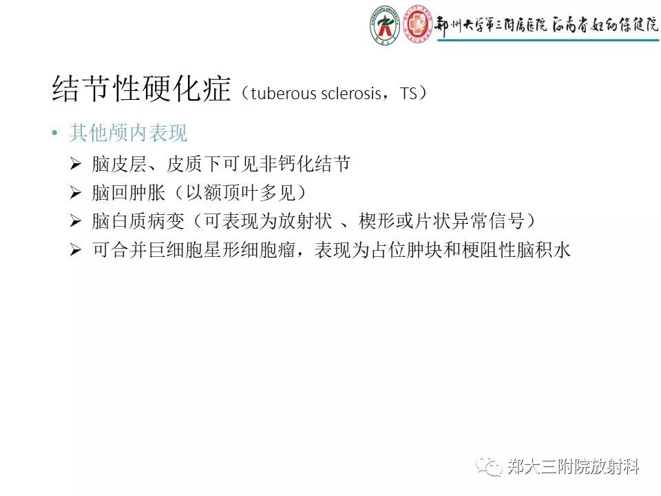 【PPT】颅内钙化性疾病的鉴别诊断