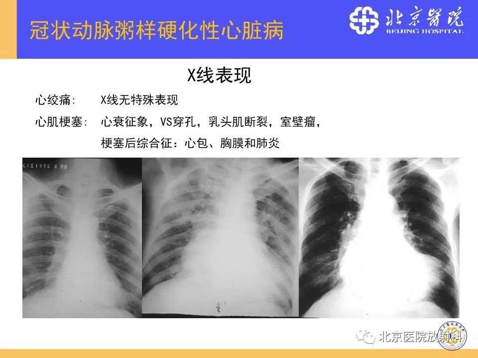 【PPT】心脏病变的影像诊断