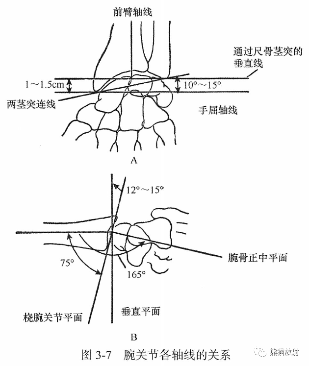 骨关节画线及测量