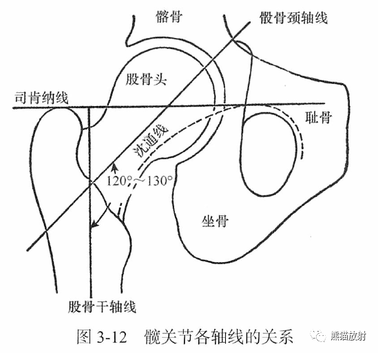 骨关节画线及测量
