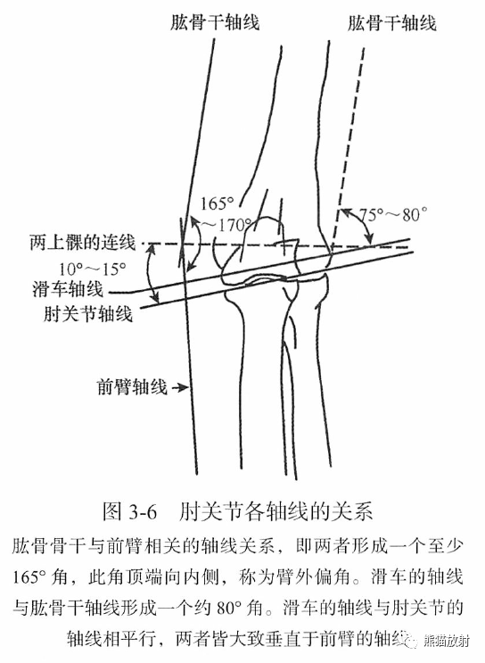 骨关节画线及测量