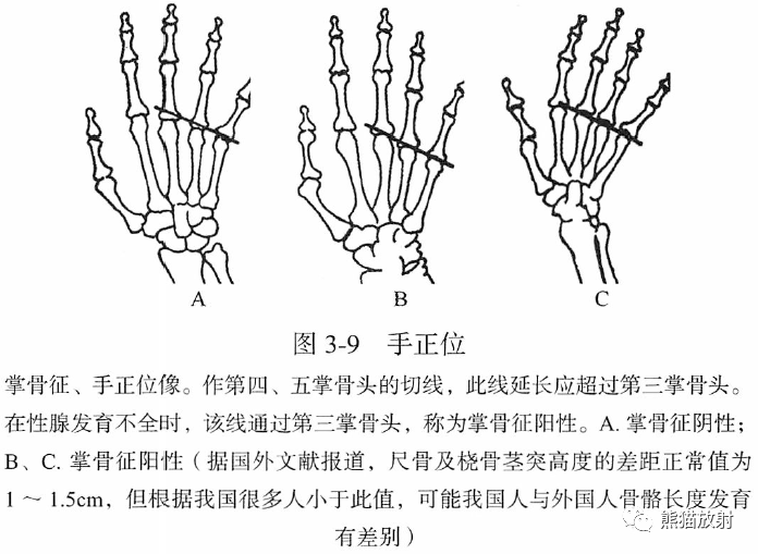 骨关节画线及测量