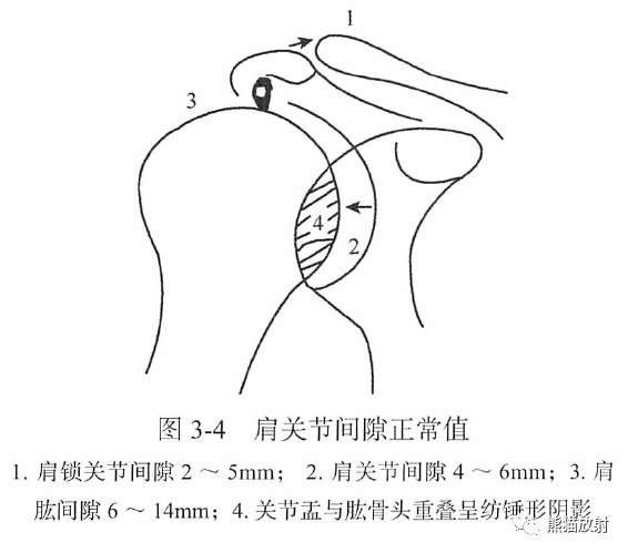 骨关节画线及测量