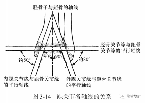 骨关节画线及测量
