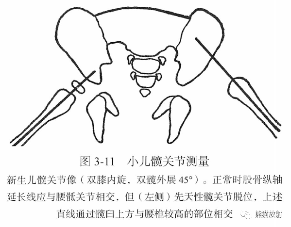 骨关节画线及测量