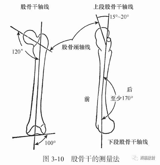骨关节画线及测量
