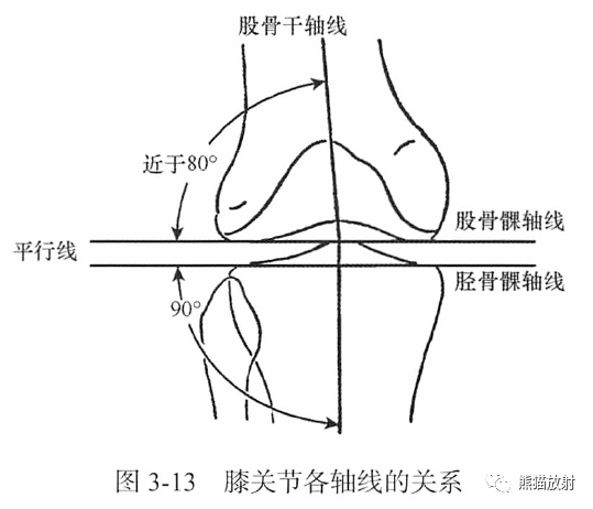 骨关节画线及测量