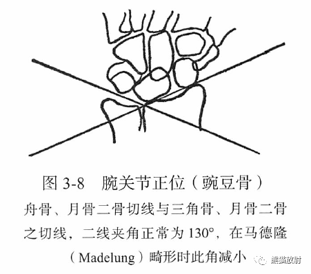 骨关节画线及测量