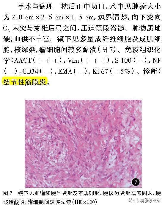 【病例】颈椎结节性筋膜炎1例CT及MR影像