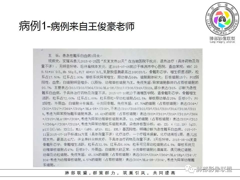 【PPT】侵袭性肺曲霉病影像分型及表现