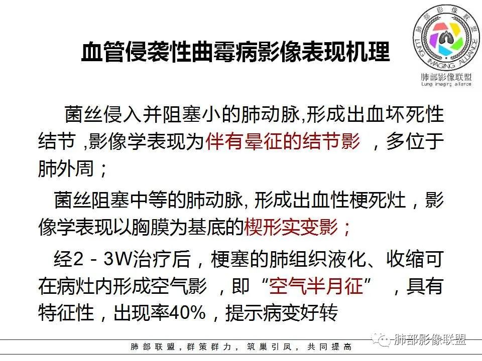 【PPT】侵袭性肺曲霉病影像分型及表现