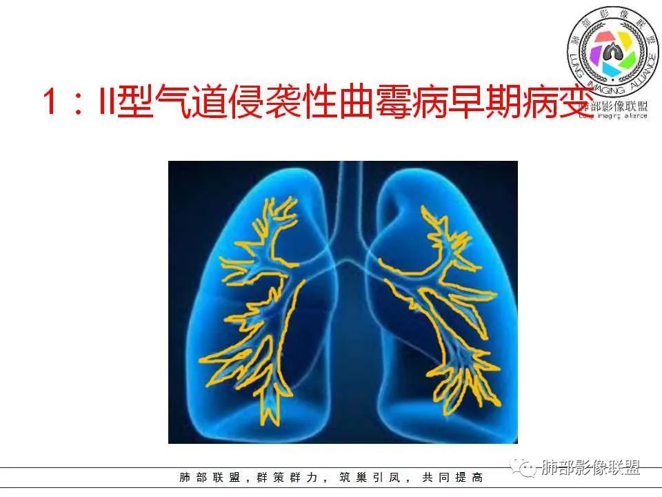 【PPT】侵袭性肺曲霉病影像分型及表现