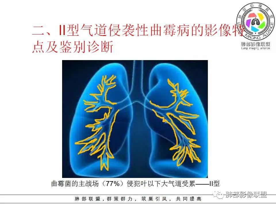【PPT】侵袭性肺曲霉病影像分型及表现
