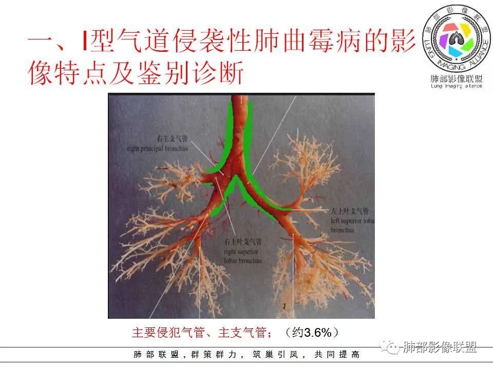 【PPT】侵袭性肺曲霉病影像分型及表现