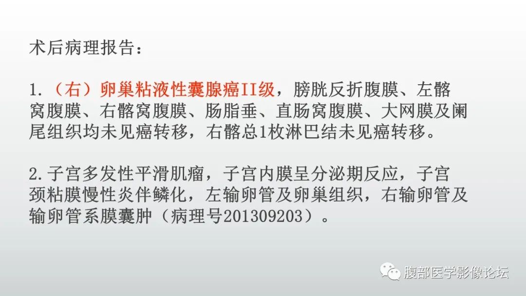 【病例】卵巢粘液性囊腺癌1例CT影像