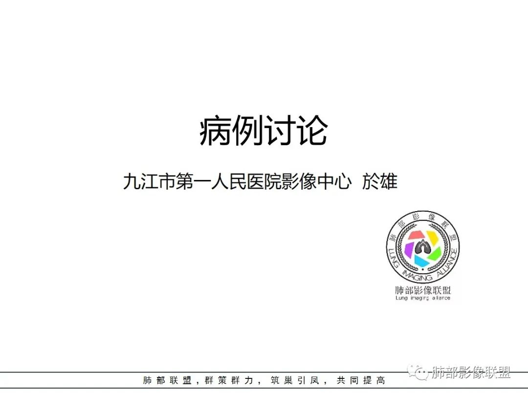 【病例】让人琢磨不透的肺肿块—肺癌1例CT影像