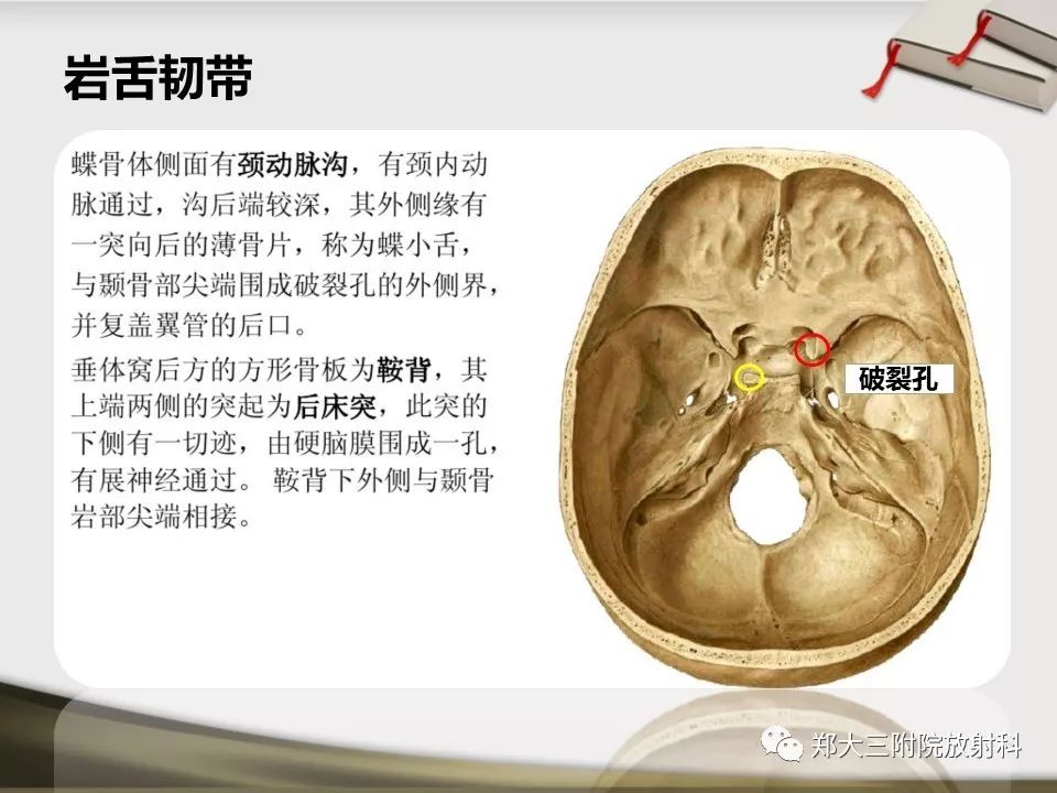 【PPT】头颈联合CTA临床应用