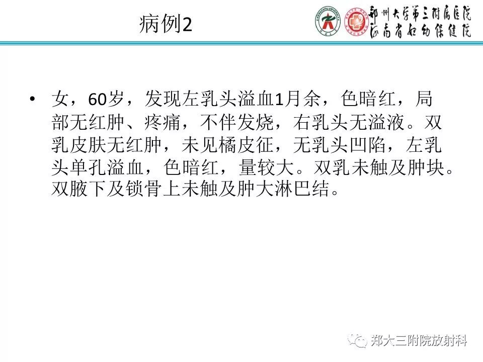 【PPT】乳腺导管内癌的X线表现