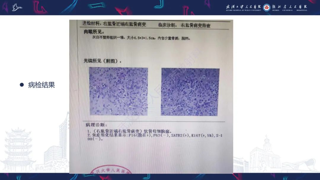 【PPT】