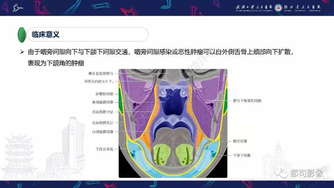 【PPT】咽旁间隙解剖及病变影像诊断 【PPT】咽旁间隙解剖及病变影像诊断