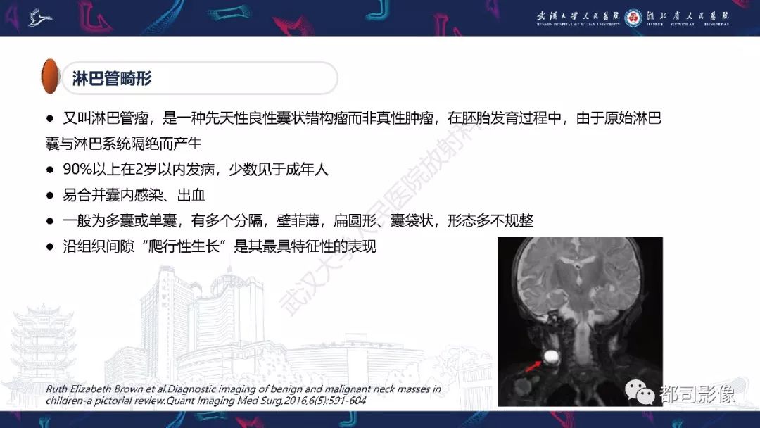 【PPT】咽旁间隙解剖及病变影像诊断 【PPT】咽旁间隙解剖及病变影像诊断