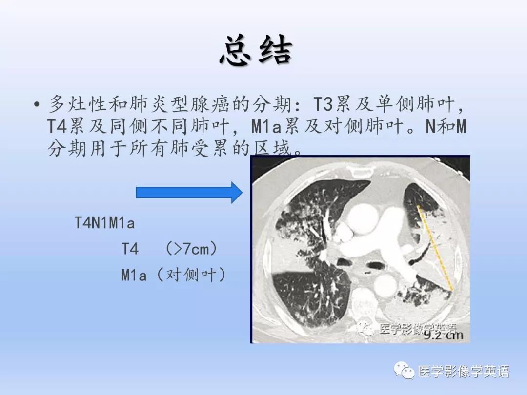 【PPT】第八版肺腺癌TNM分期影像学解读