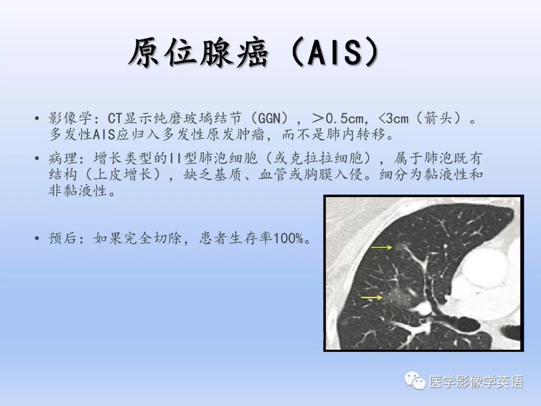 【PPT】第八版肺腺癌TNM分期影像学解读
