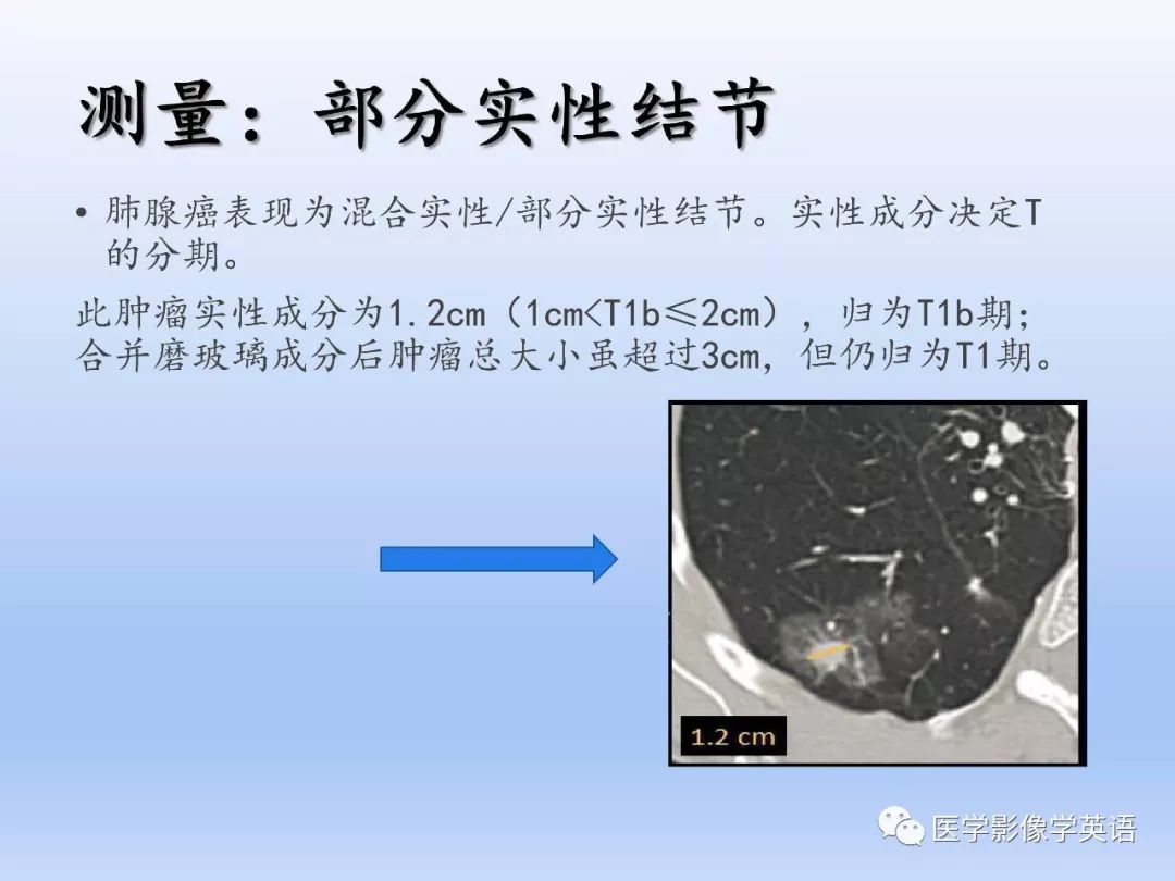【PPT】第八版肺腺癌TNM分期影像学解读