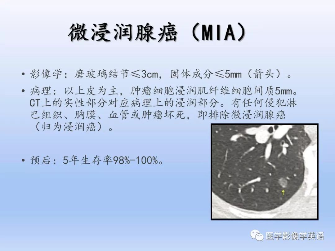【PPT】第八版肺腺癌TNM分期影像学解读