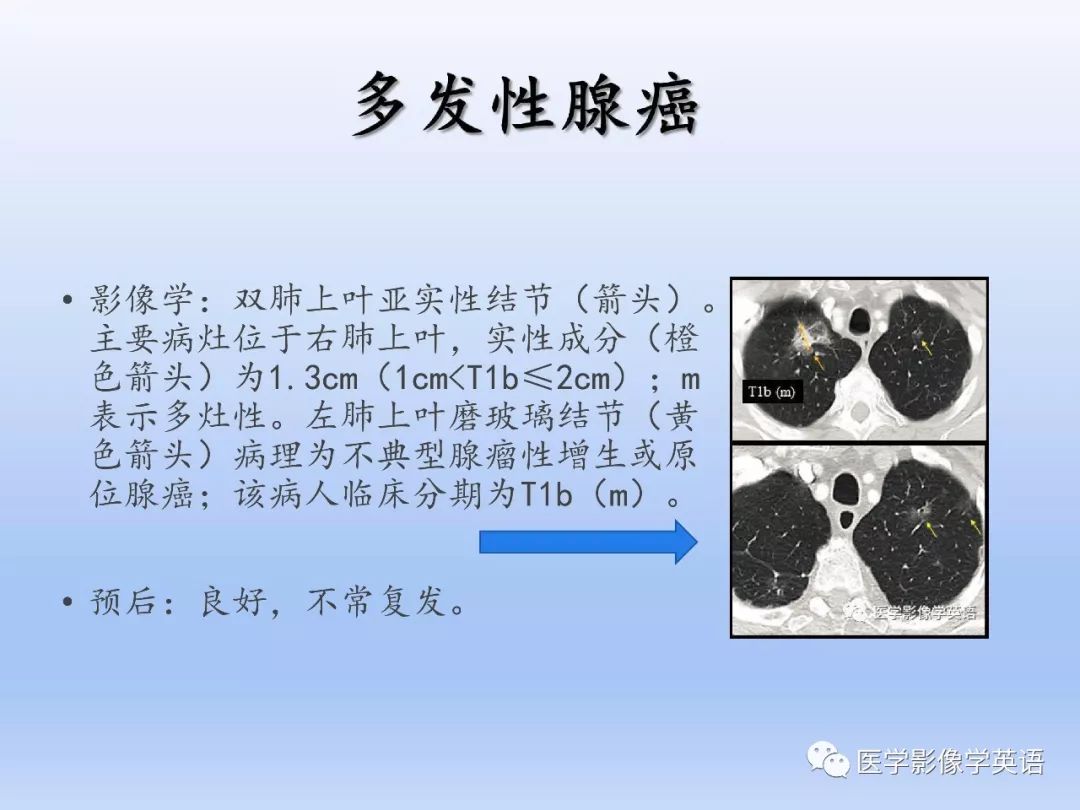 【PPT】第八版肺腺癌TNM分期影像学解读
