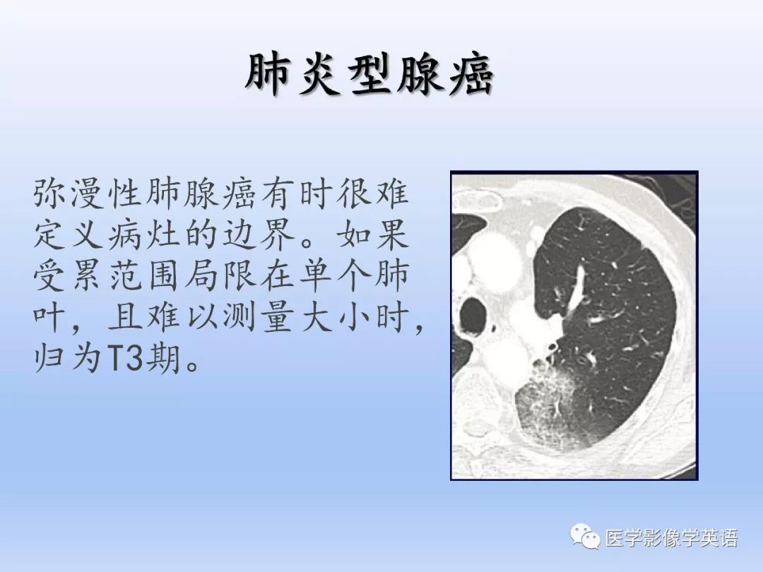 【PPT】第八版肺腺癌TNM分期影像学解读