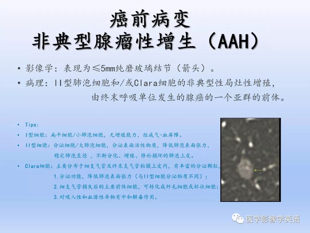 【PPT】第八版肺腺癌TNM分期影像学解读
