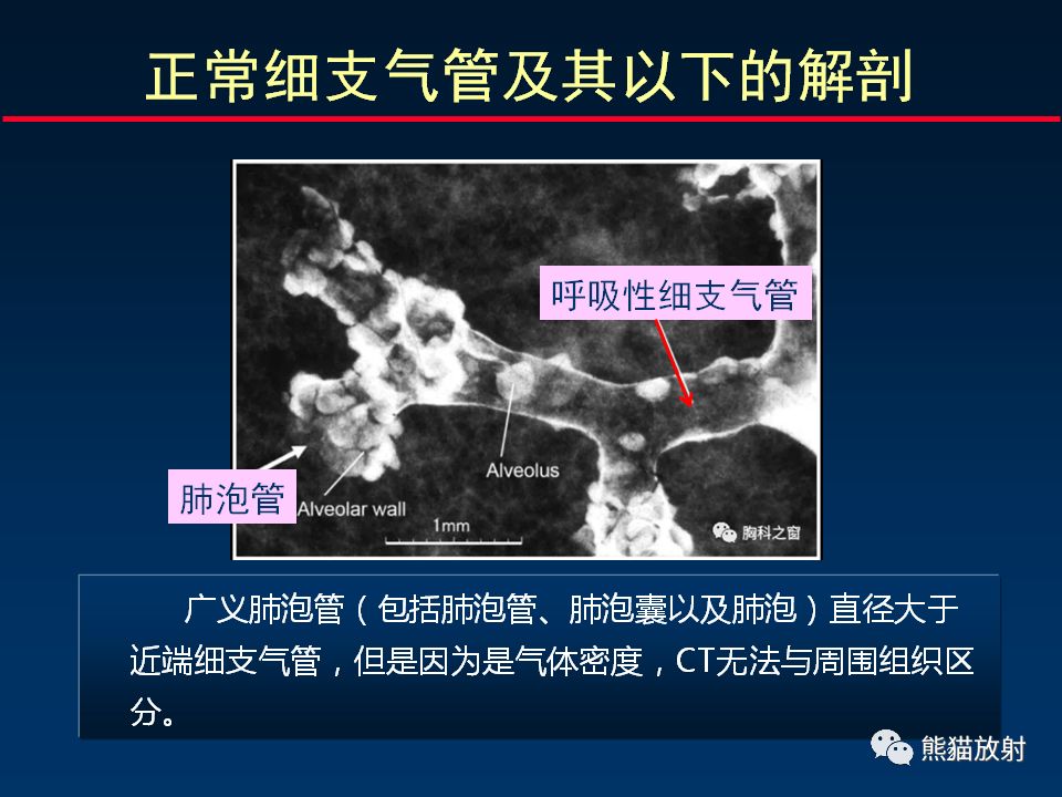 【PPT】正确判读支气管异常的CT征象 【PPT】正确判读支气管异常的CT征象