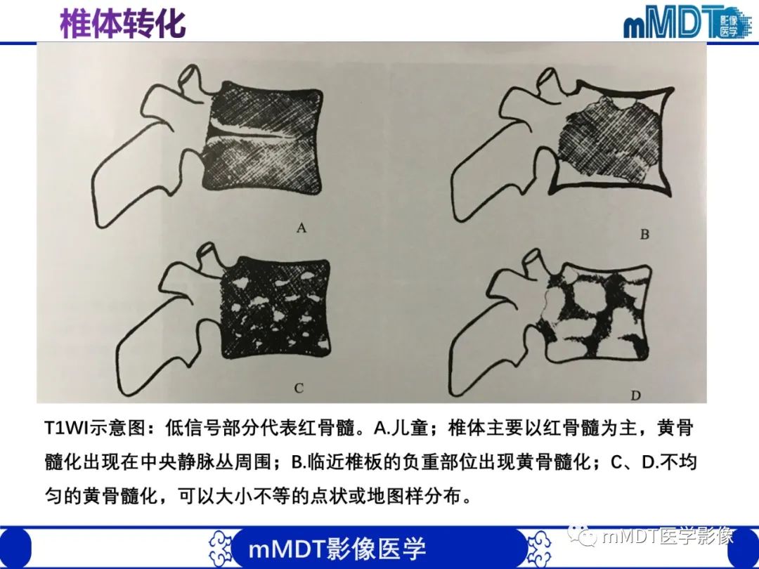【PPT】骨髓的转化与逆转化