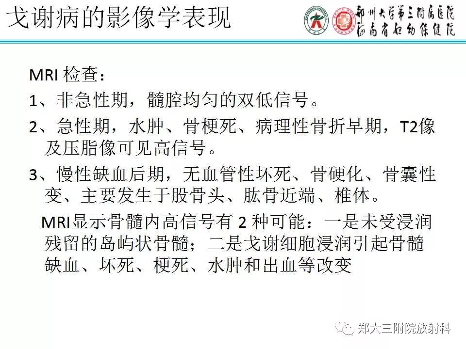 【PPT】戈谢病的影像 【PPT】戈谢病的影像