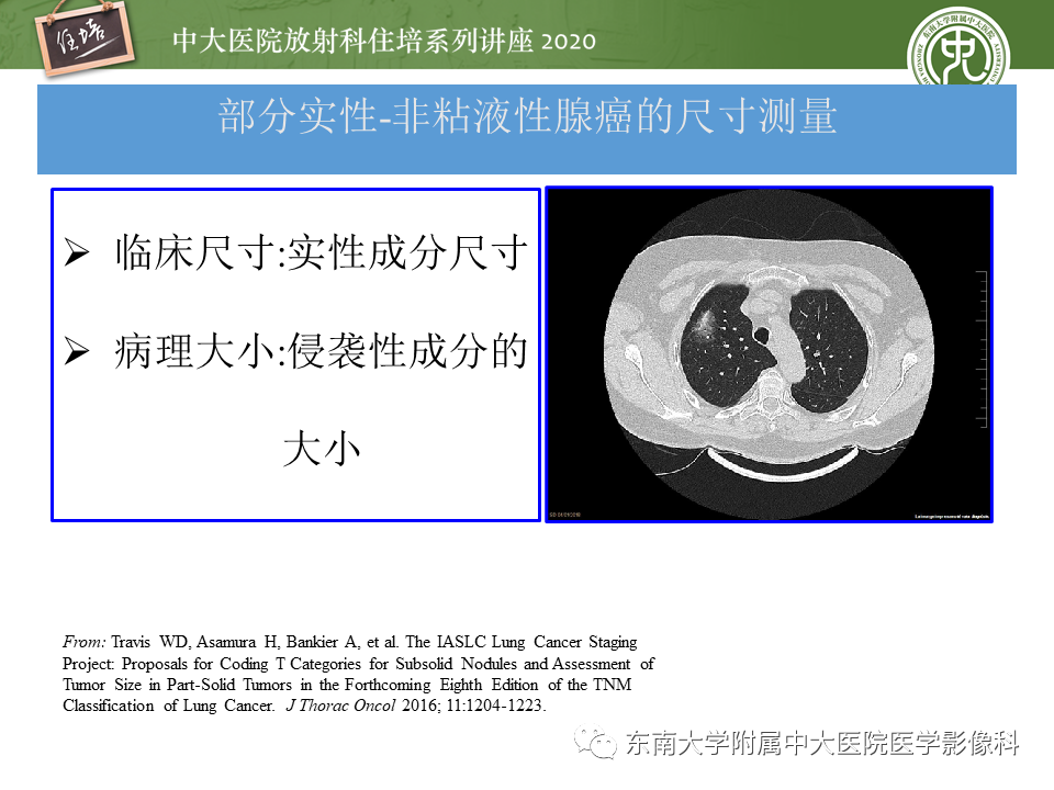 【PPT】肺癌TNM分期（UICC第8版）解读