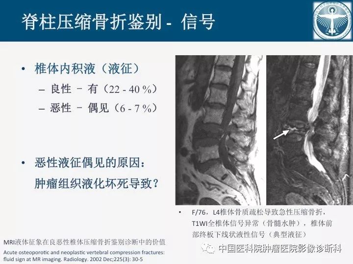 【PPT】椎体压缩骨折MRI鉴别诊断 【PPT】椎体压缩骨折MRI鉴别诊断