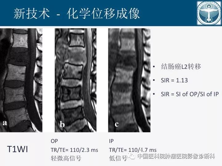 【PPT】椎体压缩骨折MRI鉴别诊断 【PPT】椎体压缩骨折MRI鉴别诊断