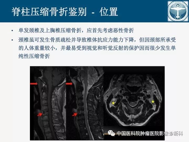 【PPT】椎体压缩骨折MRI鉴别诊断 【PPT】椎体压缩骨折MRI鉴别诊断