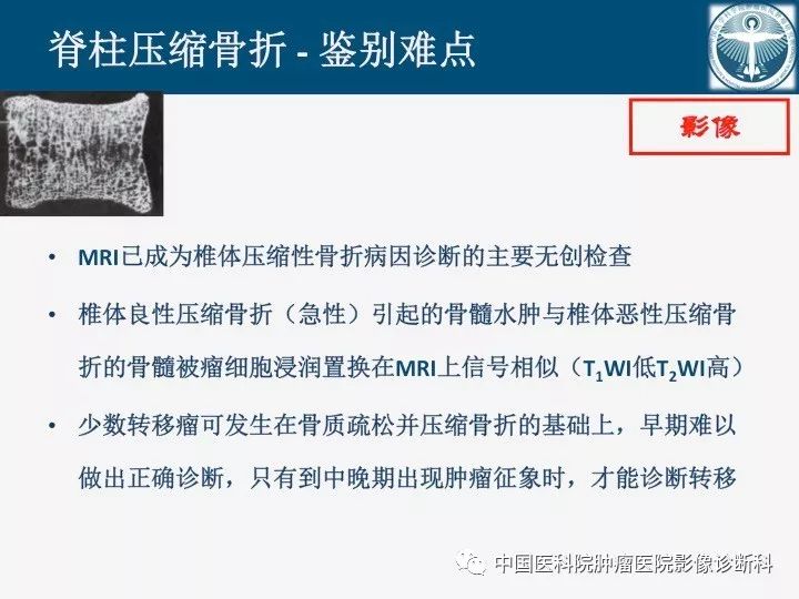 【PPT】椎体压缩骨折MRI鉴别诊断
