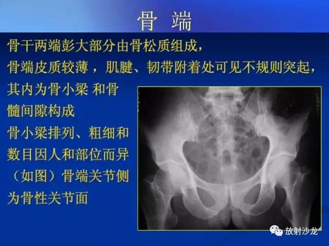 【PPT】骨、关节X线表现、正常变异